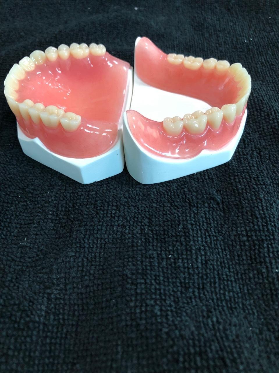 Lower dentures